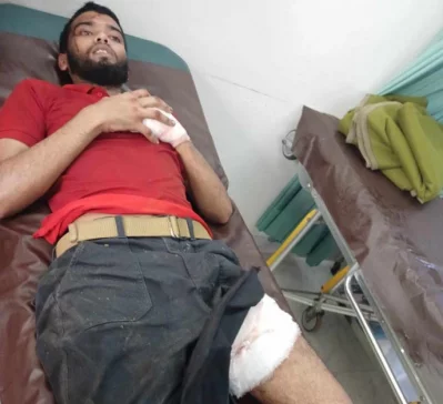 গুলিতে আহত এক শ্রমিক। সংগৃহীত ইমেজ।