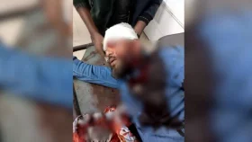 এবার প্রকাশ্যে খুলনায় এনসিপি নেতার মাথায় গুলি, অবস্থা গুরুতর