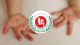 হাম উপসর্গে দেশে আরও এক মৃত্যু, শনাক্ত ১১৩