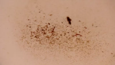 জুরাইনে ময়লা আর পোকার কারণে খাওয়া যায় না ওয়াসার পানি